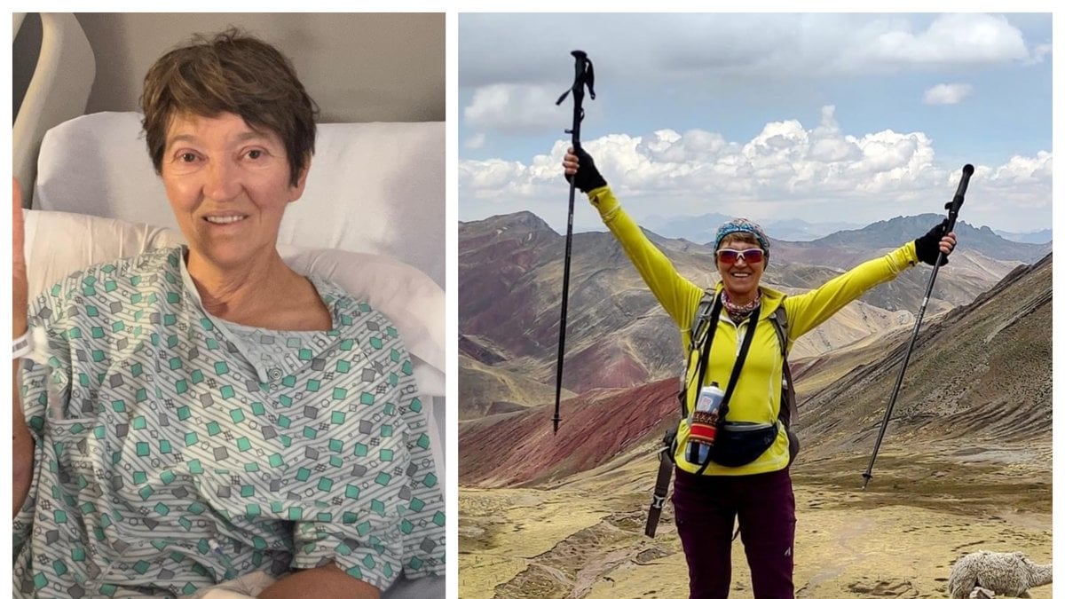 Eva Simons, 64, tvingades amputera sitt vänstra ben efter hundattacken.